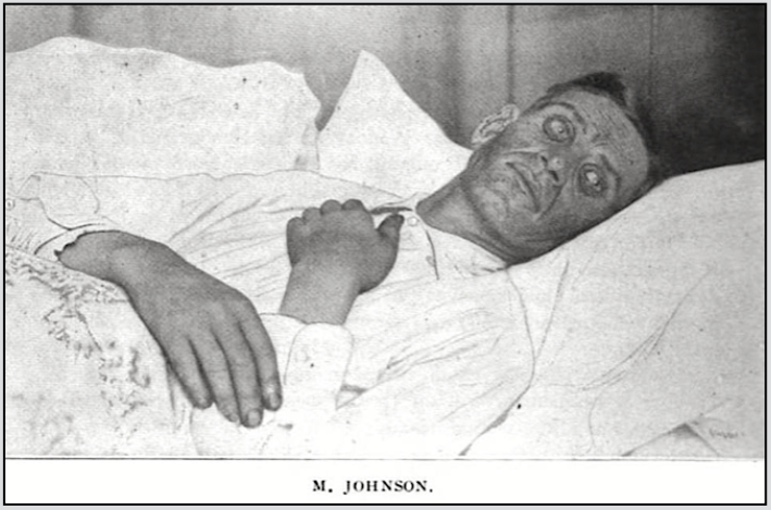 IWW Spk FSF, M Johnson, ISR p834, Mar 1910