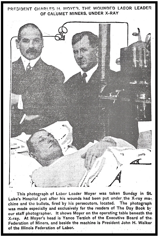 Moyer in Hospital, Terzich, JHW, Day Book p6, Dec 29, 1913